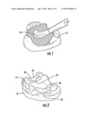 METHOD OF MAKING AN ORAL PROSTHESIS diagram and image