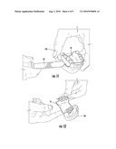 METHOD OF MAKING AN ORAL PROSTHESIS diagram and image