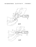 METHOD OF MAKING AN ORAL PROSTHESIS diagram and image