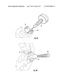 METHOD OF MAKING AN ORAL PROSTHESIS diagram and image