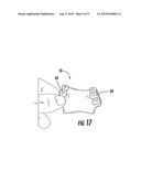 METHOD OF MAKING AN ORAL PROSTHESIS diagram and image