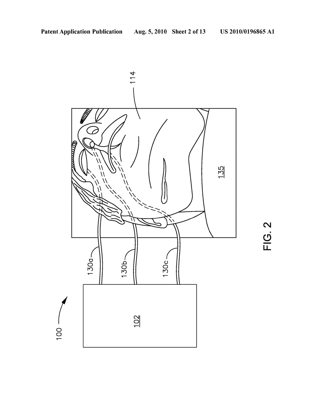 FLUID DELIVERY SYSTEM FOR PATIENT SIMULATION MANIKIN - diagram, schematic, and image 03