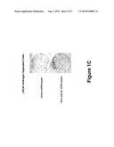 ANDROGEN-REGULATED GENES AND USES FOR DIAGNOSIS, PROGNOSIS AND TREATMENT OF PROSTATE NEOPLASTIC CONDITIONS diagram and image