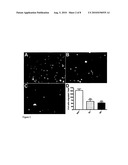 TREATING PRE-ECLEMPSIA AND CARDIOVASCULAR DISEASES diagram and image