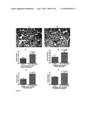 TREATING PRE-ECLEMPSIA AND CARDIOVASCULAR DISEASES diagram and image