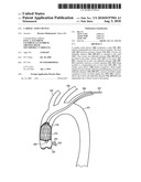 Cardiac Assist Device diagram and image