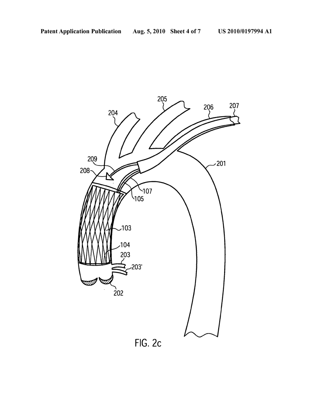 Cardiac Assist Device - diagram, schematic, and image 05