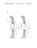 ADJUSTABLE SURGICAL SLING diagram and image