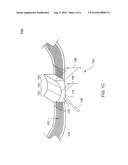 ADJUSTABLE SURGICAL SLING diagram and image