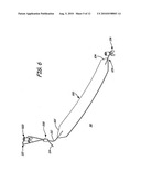 IMPLANTABLE DEVICES, TOOLS AND METHODS FOR ANATOMICAL SUPPORT diagram and image