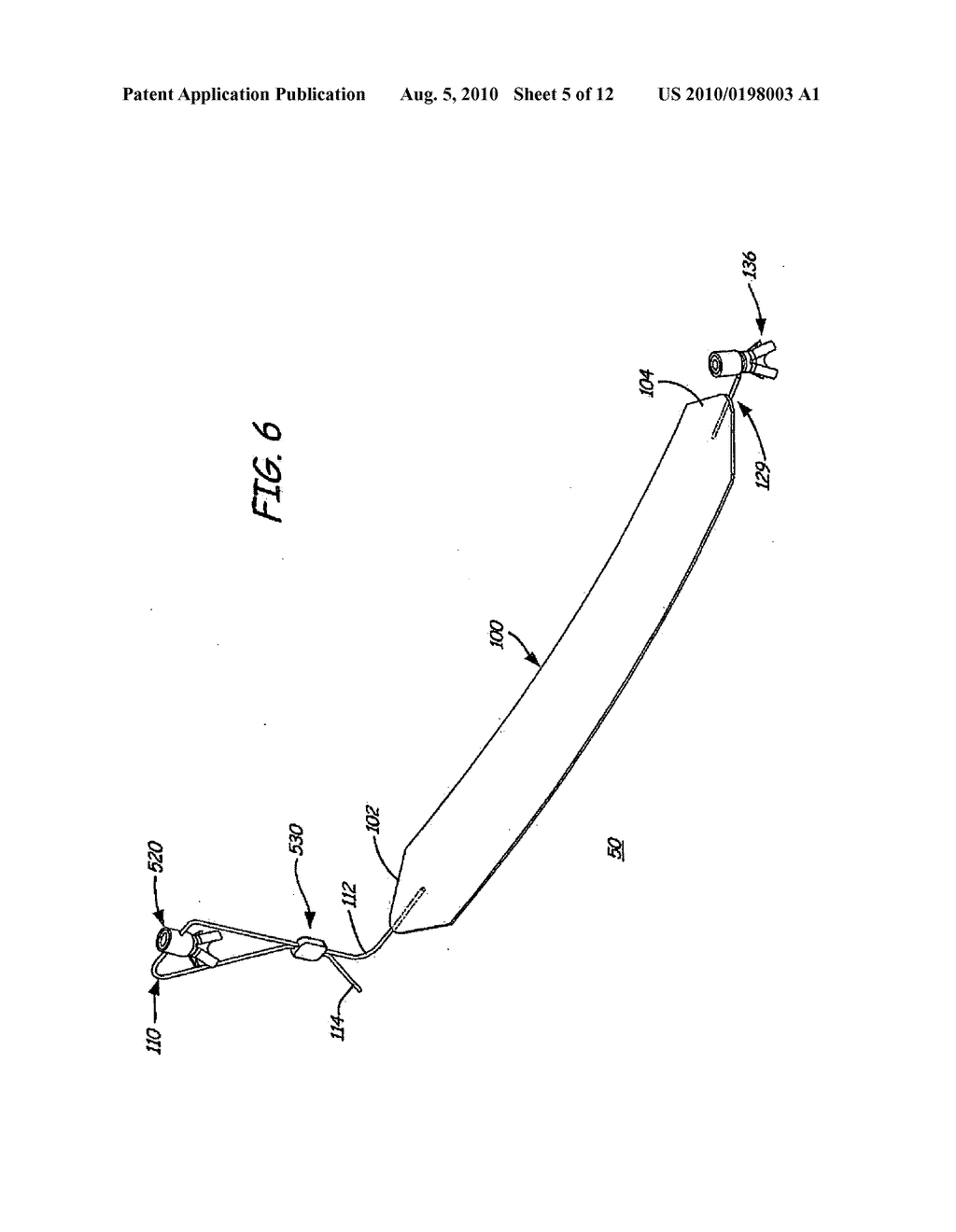 IMPLANTABLE DEVICES, TOOLS AND METHODS FOR ANATOMICAL SUPPORT - diagram, schematic, and image 06