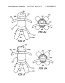 IMPLANTABLE DEVICES, TOOLS AND METHODS FOR ANATOMICAL SUPPORT diagram and image