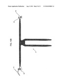 IMPLANTABLE DEVICES, TOOLS AND METHODS FOR ANATOMICAL SUPPORT diagram and image