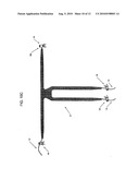 IMPLANTABLE DEVICES, TOOLS AND METHODS FOR ANATOMICAL SUPPORT diagram and image