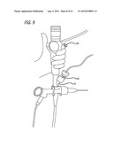 System Of Accessories For Use With Bronchoscopes diagram and image