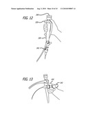 System Of Accessories For Use With Bronchoscopes diagram and image