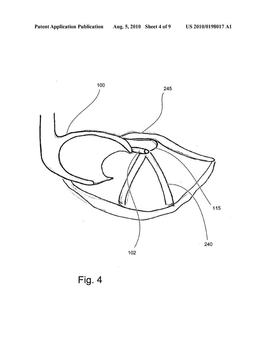 Laryngoscope Blade - diagram, schematic, and image 05