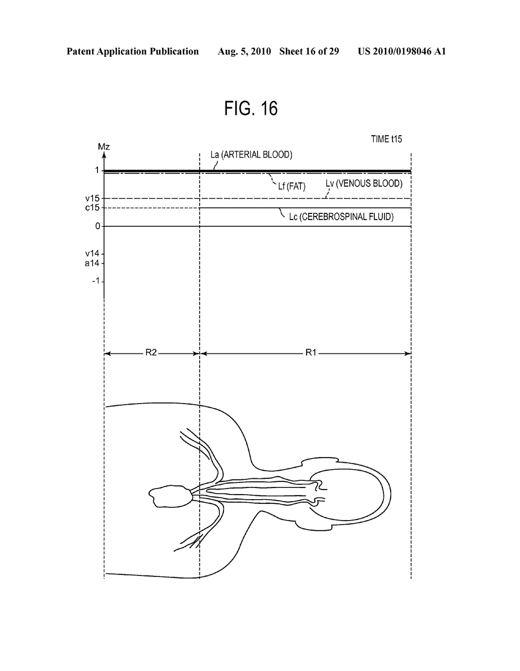 MAGNETIC RESONANCE IMAGING APPARATUS AND PROGRAM - diagram, schematic, and image 17