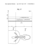 MAGNETIC RESONANCE IMAGING APPARATUS AND PROGRAM diagram and image