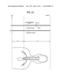 MAGNETIC RESONANCE IMAGING APPARATUS AND PROGRAM diagram and image