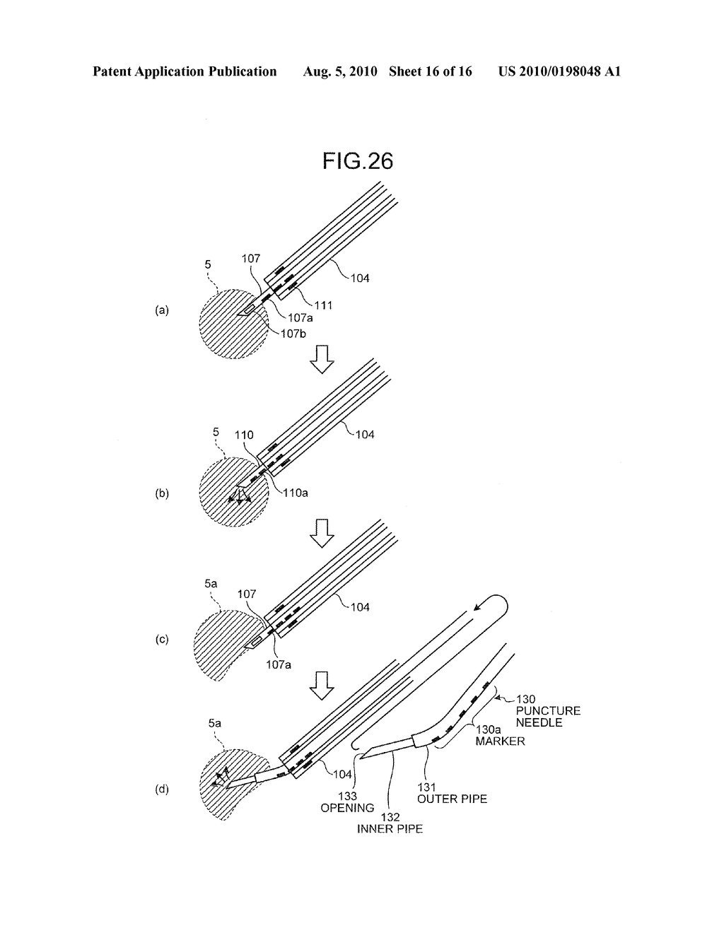 MEDICINAL-SOLUTION ADMINISTRATION SYSTEM AND MEDICINAL-SOLUTION ADMINISTRATION CANNULA - diagram, schematic, and image 17