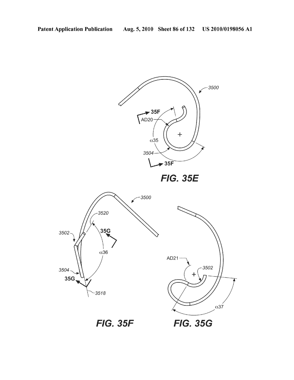 Diagnostic catheters, guide catheters, visualization devices and chord manipulation devices, and related kits and methods - diagram, schematic, and image 87