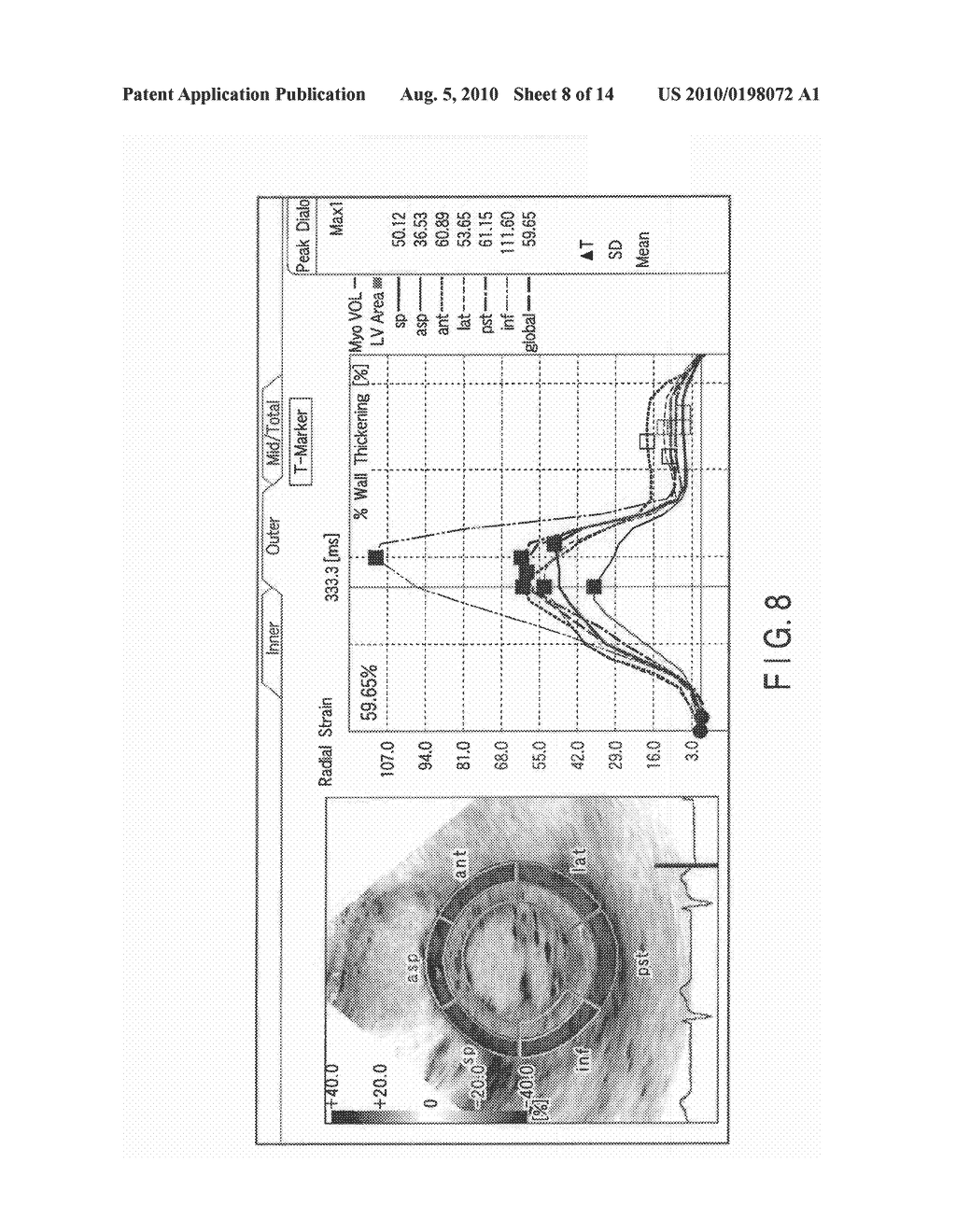 ULTRASONIC DIAGNOSTIC APPARATUS, ULTRASONIC IMAGE PROCESSING APPARATUS, MEDICAL IMAGE DIAGNOSTIC APPARATUS, MEDICAL IMAGE PROCESSING APPARATUS, ULTRASONIC IMAGE PROCESSING METHOD, AND MEDICAL IMAGE PROCESSING METHOD - diagram, schematic, and image 09