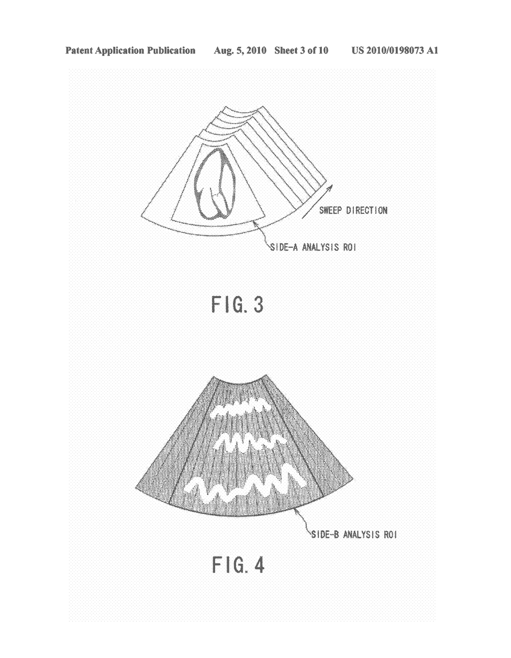 ULTRASONIC DIAGNOSTIC APPARATUS AND CONTROLLING METHOD OF ULTRASONIC DIAGNOSTIC APPARATUS - diagram, schematic, and image 04