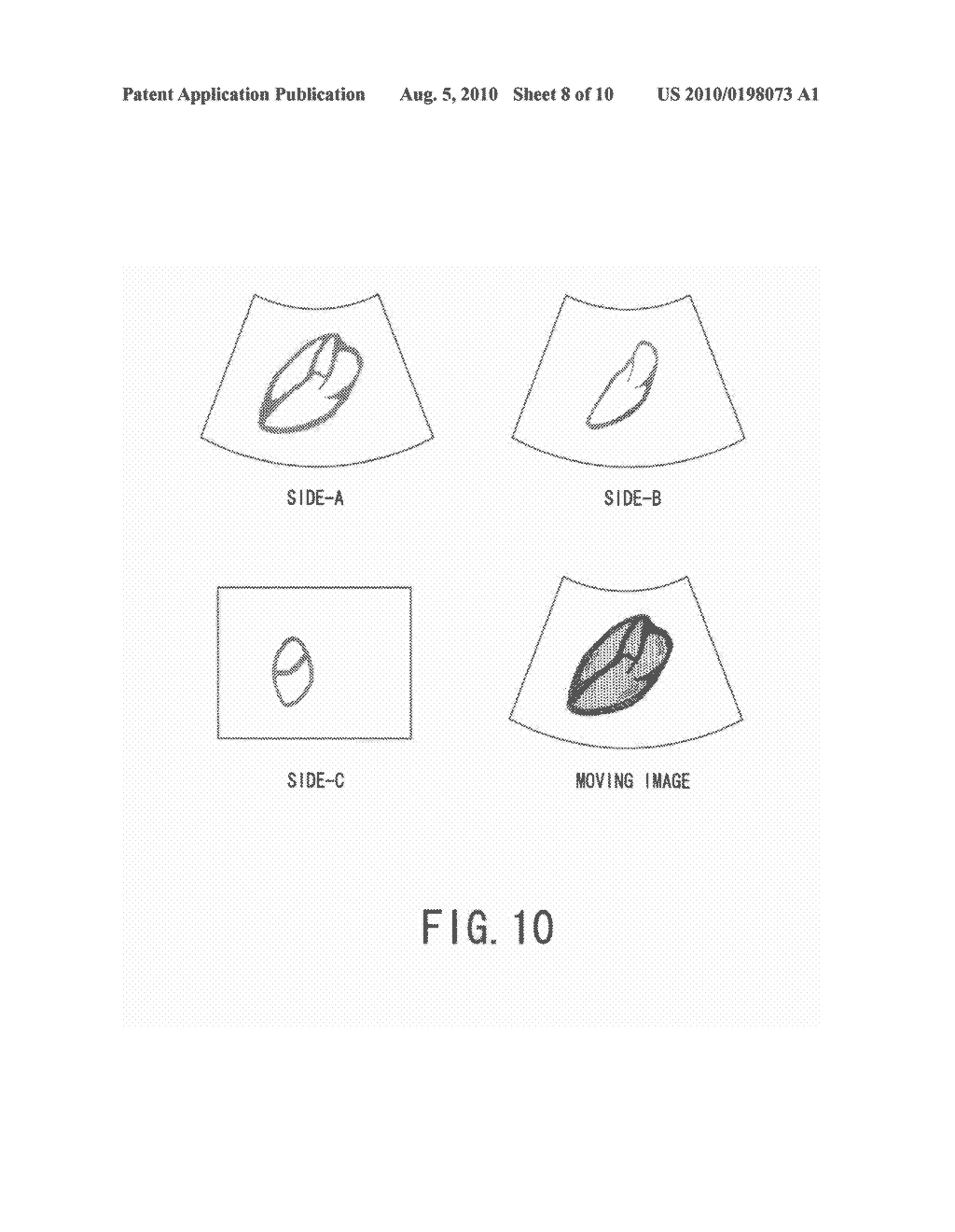 ULTRASONIC DIAGNOSTIC APPARATUS AND CONTROLLING METHOD OF ULTRASONIC DIAGNOSTIC APPARATUS - diagram, schematic, and image 09