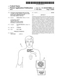 Systems and Methods for Use with an Implantable Medical Device for Detecting Stroke Based on Electrocardiac Signals diagram and image