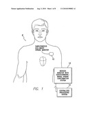 Systems and Methods for Use with an Implantable Medical Device for Detecting Stroke Based on Electrocardiac Signals diagram and image