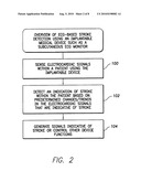 Systems and Methods for Use with an Implantable Medical Device for Detecting Stroke Based on Electrocardiac Signals diagram and image