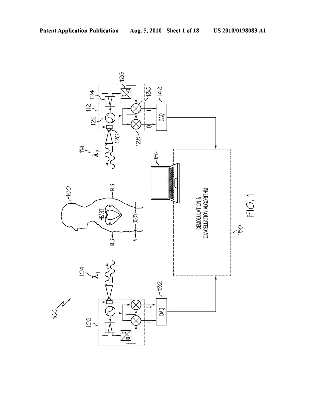 Random Body Movement Cancellation for Non-Contact Vital Sign Detection - diagram, schematic, and image 02