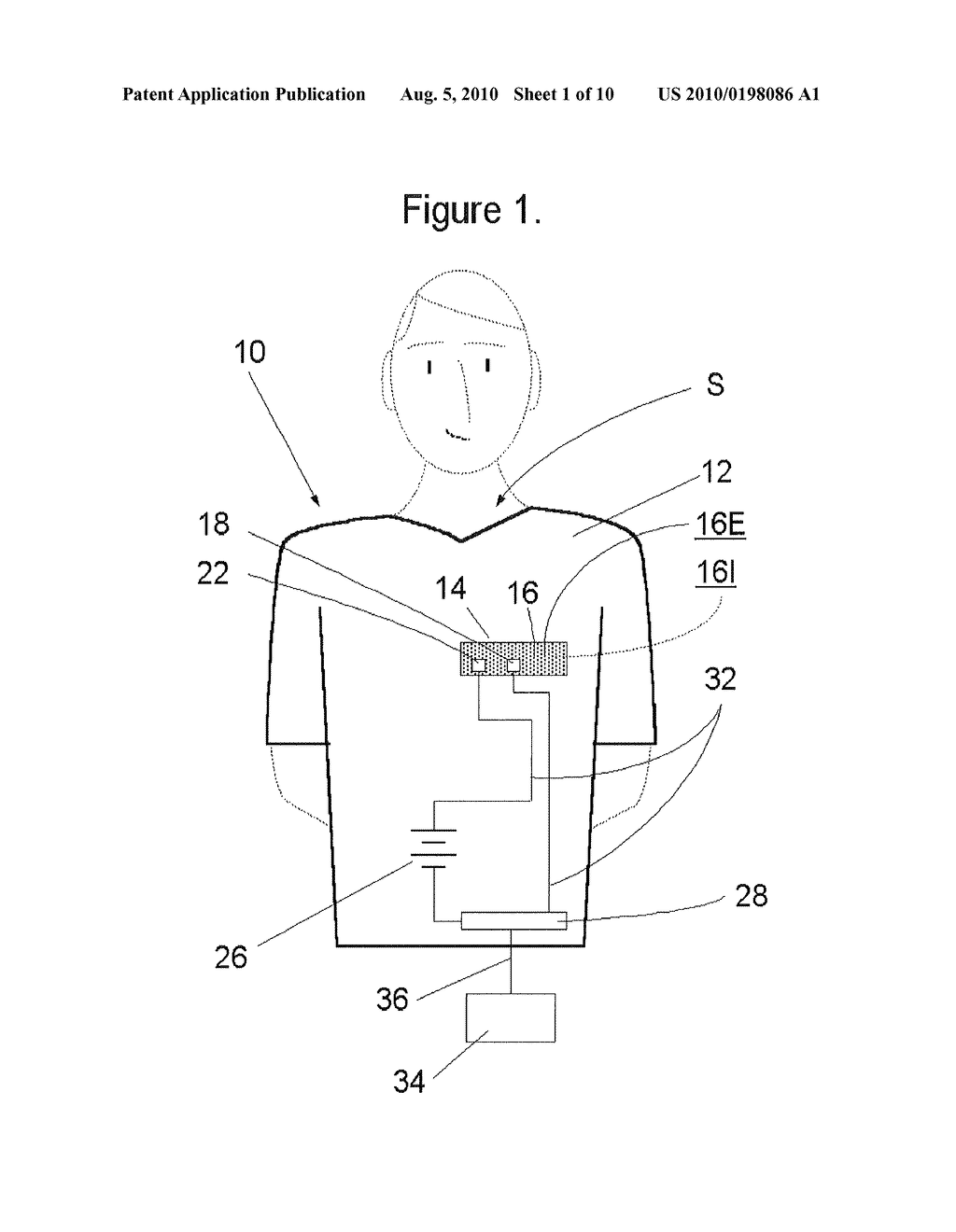 EXTENDED OPTICAL RANGE SYSTEM FOR MONITORING MOTION OF A MEMBER - diagram, schematic, and image 02