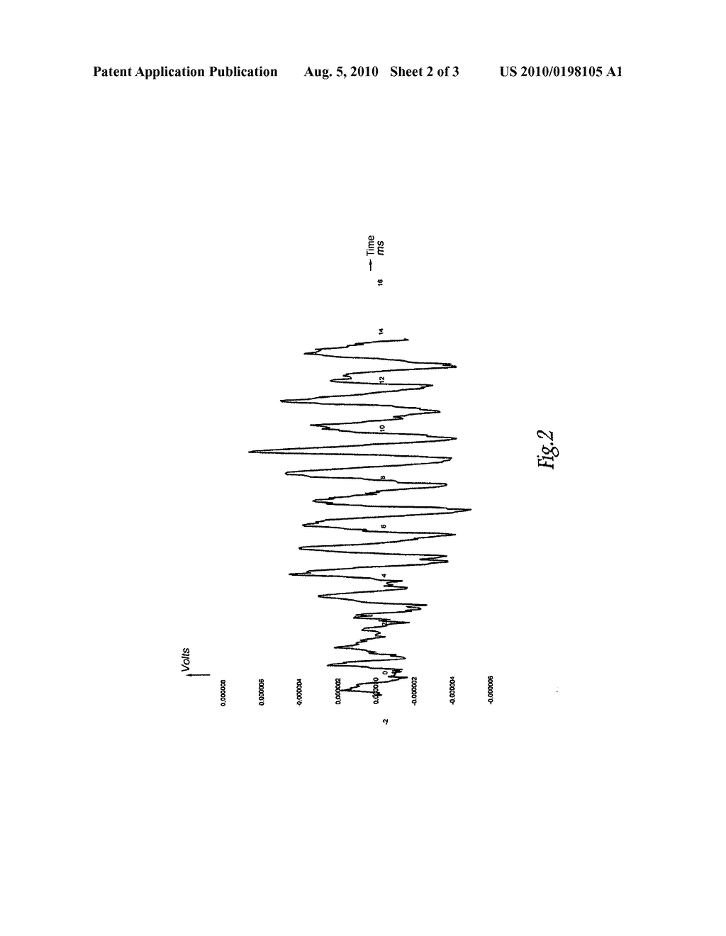 NON INVASIVE METHOD FOR DETECTING AN ELECTRONIC PARAMETER DEPENDING ON THE INTRALABYRINTH PRESSURE (PIL) IN A SUBJECT - diagram, schematic, and image 03