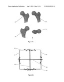 METHOD AND DEVICE FOR DETERMINING A CHARACTERISTIC PROPERTY OF AN ANATOMICAL STRUCTURE diagram and image