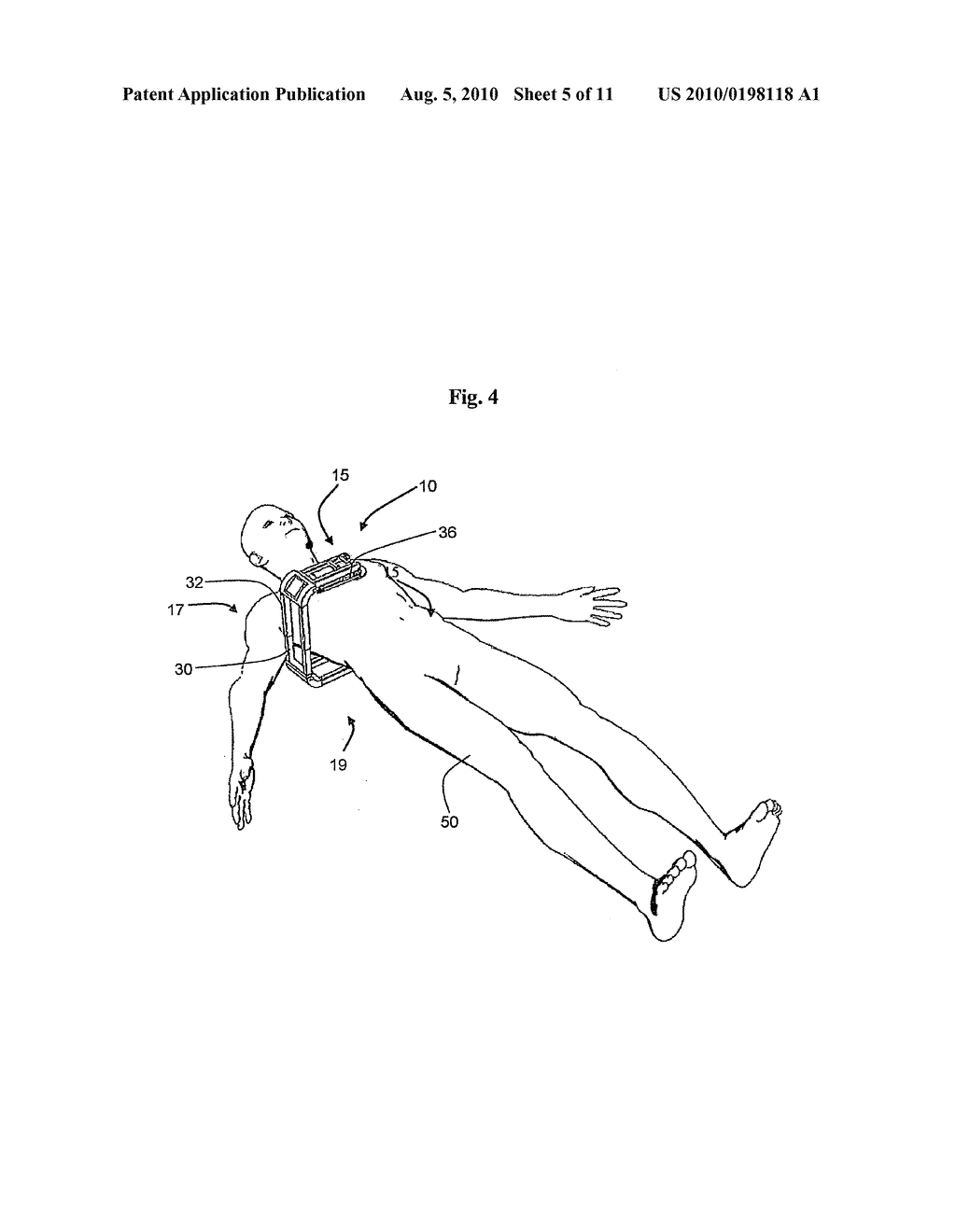 Augmenting force-delivery in belt-type ECM devices - diagram, schematic, and image 06