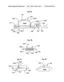 Augmenting force-delivery in belt-type ECM devices diagram and image