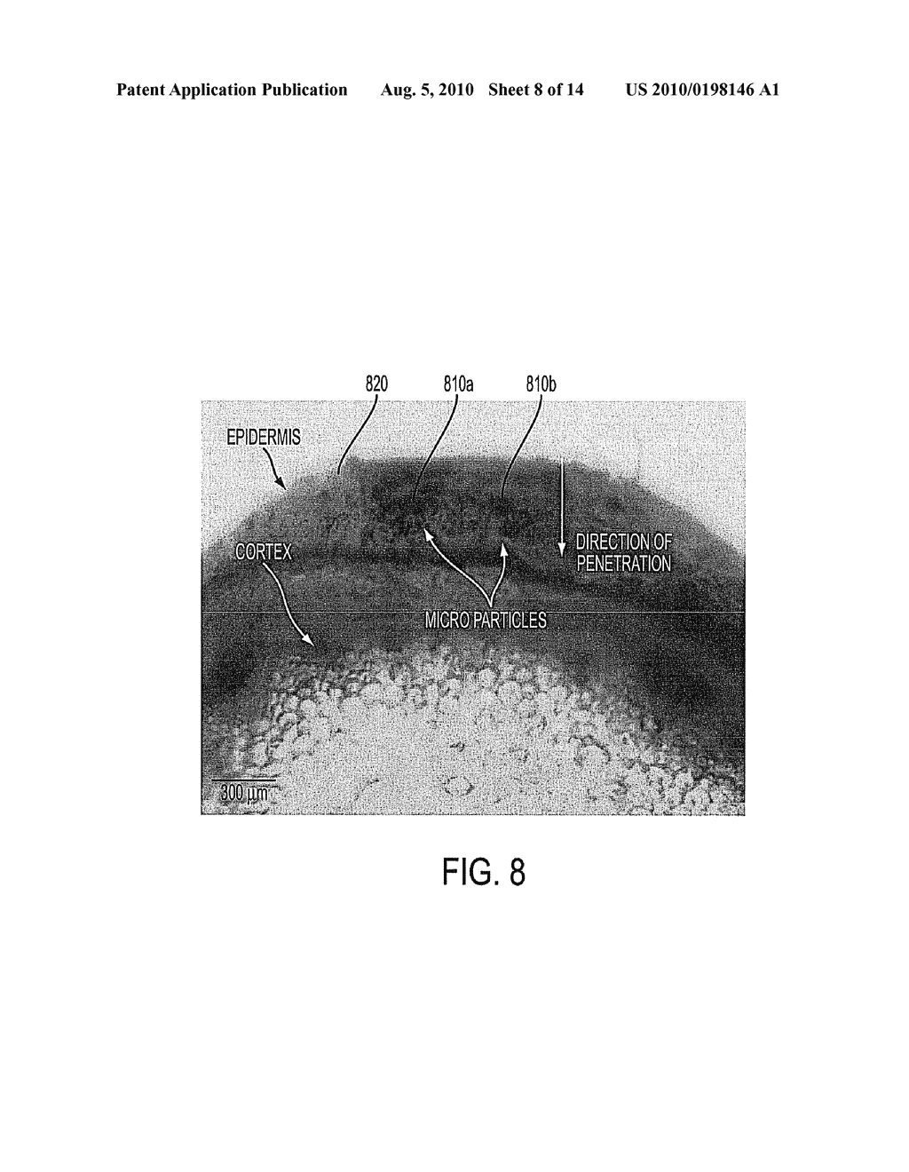 APPARATUS AND METHOD FOR DELIVERING BIOLOGICALLY-ACTIVE SUBSTANCES OR MICRO-MEDICAL DEVICES TO A TARGET - diagram, schematic, and image 09