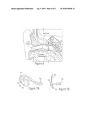 MEDICAL DEVICES INCORPORATING THERMOELECTRIC TRANSDUCER AND CONTROLLER diagram and image