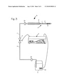 Low Pressure Liquid Nitrogen Cryosurgical System diagram and image