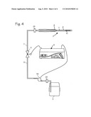 Low Pressure Liquid Nitrogen Cryosurgical System diagram and image