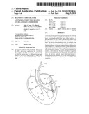 DIAGNOSTIC CATHETERS, GUIDE CATHETERS, VISUALIZATION DEVICES AND CHORD MANIPULATION DEVICES, AND RELATED KITS AND METHODS diagram and image