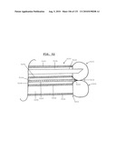 DIAGNOSTIC CATHETERS, GUIDE CATHETERS, VISUALIZATION DEVICES AND CHORD MANIPULATION DEVICES, AND RELATED KITS AND METHODS diagram and image