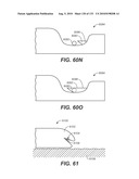 DIAGNOSTIC CATHETERS, GUIDE CATHETERS, VISUALIZATION DEVICES AND CHORD MANIPULATION DEVICES, AND RELATED KITS AND METHODS diagram and image