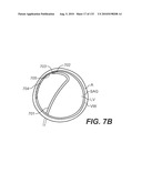 DIAGNOSTIC CATHETERS, GUIDE CATHETERS, VISUALIZATION DEVICES AND CHORD MANIPULATION DEVICES, AND RELATED KITS AND METHODS diagram and image