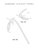 DIAGNOSTIC CATHETERS, GUIDE CATHETERS, VISUALIZATION DEVICES AND CHORD MANIPULATION DEVICES, AND RELATED KITS AND METHODS diagram and image