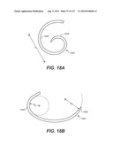 DIAGNOSTIC CATHETERS, GUIDE CATHETERS, VISUALIZATION DEVICES AND CHORD MANIPULATION DEVICES, AND RELATED KITS AND METHODS diagram and image