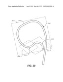 DIAGNOSTIC CATHETERS, GUIDE CATHETERS, VISUALIZATION DEVICES AND CHORD MANIPULATION DEVICES, AND RELATED KITS AND METHODS diagram and image