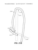DIAGNOSTIC CATHETERS, GUIDE CATHETERS, VISUALIZATION DEVICES AND CHORD MANIPULATION DEVICES, AND RELATED KITS AND METHODS diagram and image